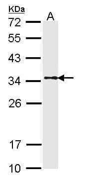 IHC-plus™ Polyclonal Rabbit anti-Human TPM1 / Tropomyosin Antibody (IHC, WB)