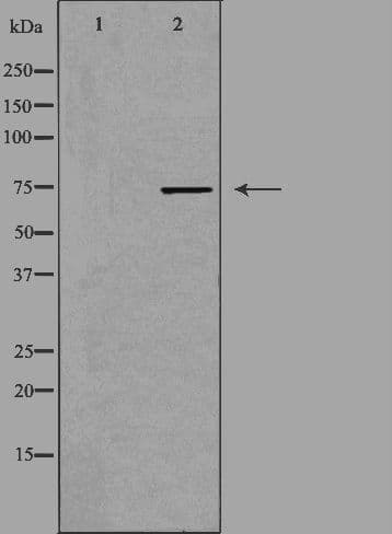 FASTKD3 Antibody