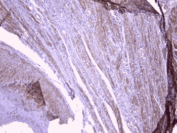 PEBP1 / RKIP Antibody