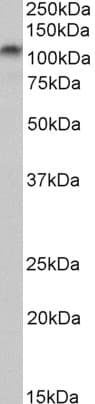 Polyclonal Goat anti-Human DLG4 / PSD95 Antibody (aa667-679, WB)