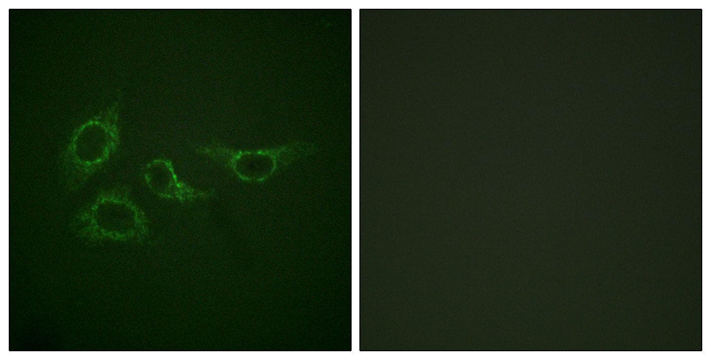 CALM1 / Calmodulin Antibody (p79/81)