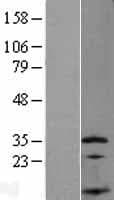 SSNA1 Protein (Over-Expression Lysate Myc-DDK (Flag))