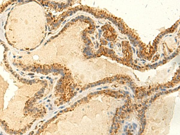 HsT19268 / MTHFS Antibody