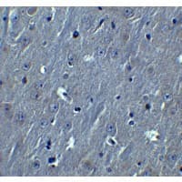 Polyclonal Rabbit anti-Human HOOK3 Antibody (IHC, IF, WB)