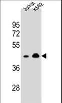 OR10A4 Antibody (aa245-273)