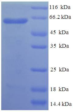 Human DJ858B16.2 / PISD Protein (Recombinant His-SUMO)