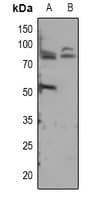 ADAM12 Antibody