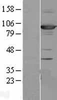 DLG3 / SAP102 Protein (Over-Expression Lysate Myc-DDK (Flag))