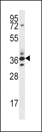 IHC-plus™ SFRP5 Antibody (aa190-219)