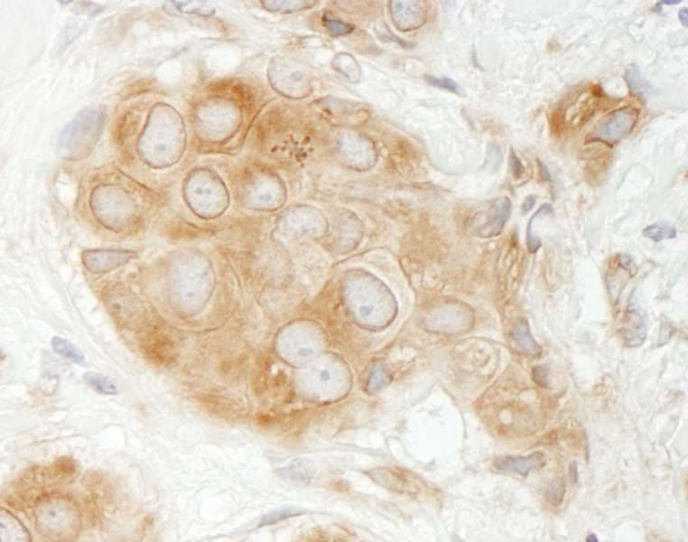 GIT1 Antibody (aa375-425)