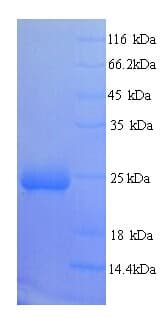 Human NIX / BNIP3L Protein (Recombinant 6His, N-terminus)