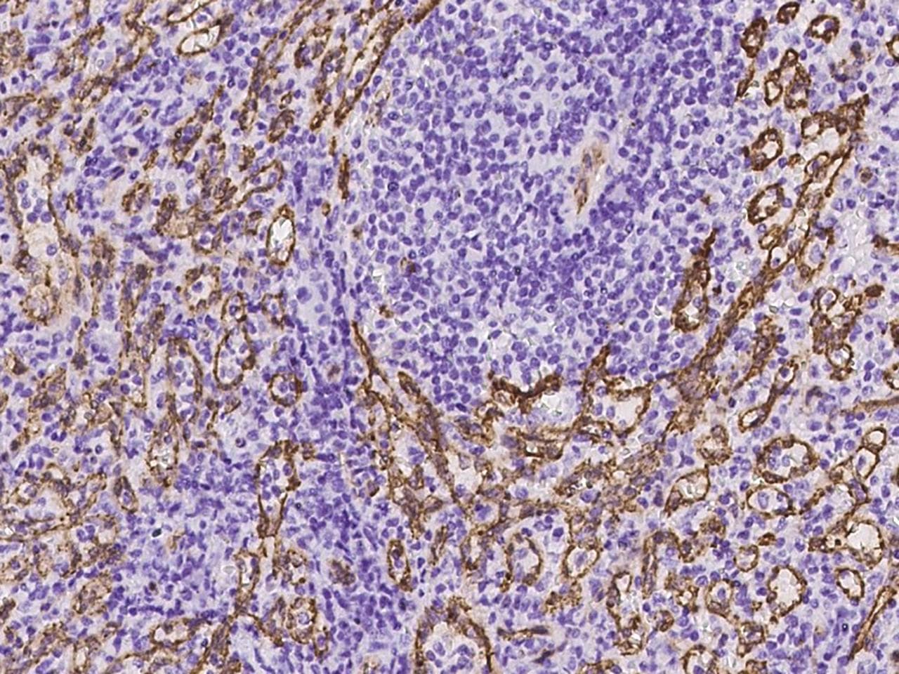 Polyclonal Rabbit anti-Human AIF1L Antibody (IHC)