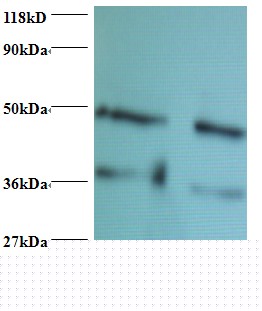 FABP3 / H-FABP Antibody (HRP)