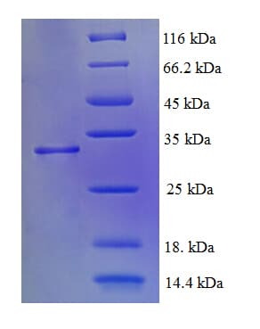 Human ATPAF2 Protein (Recombinant His)