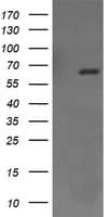 Monoclonal Mouse anti-Human CD105 Antibody (clone OTI9E5, IF, WB)