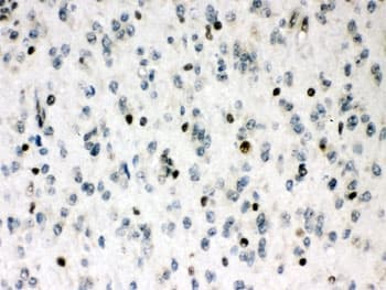 MEF2A / MEF2 Antibody