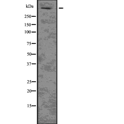 HTT / Huntingtin Antibody