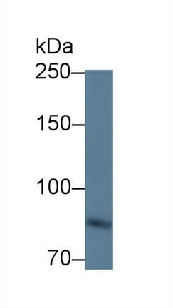 ITGB6 / Integrin Beta 6 Antibody (aa131-619, APC)