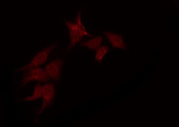 Polyclonal Rabbit anti-Human PAK1 Antibody (IHC, IF, WB)