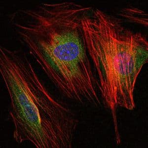 MMP9 / Gelatinase B Antibody (clone 5G3)