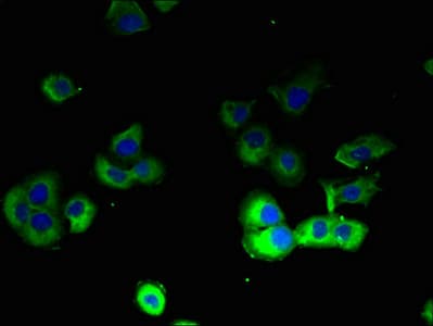 Polyclonal Rabbit anti-Human ATP12A Antibody (aa171-306, IHC)