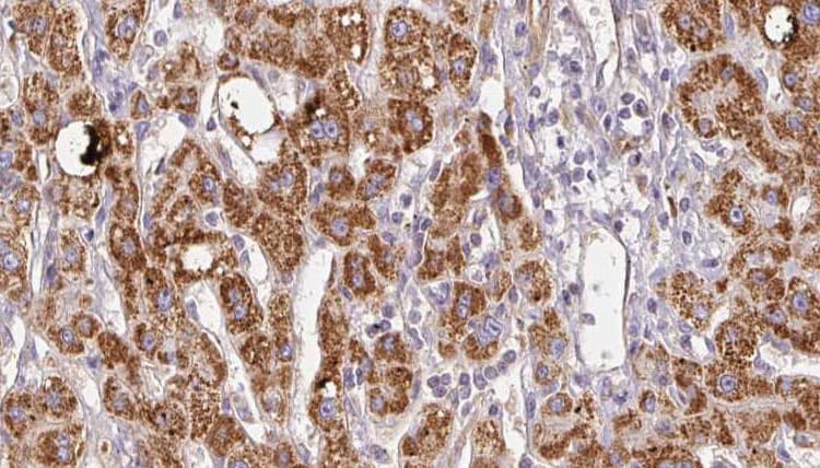 Polyclonal Rabbit anti-Human SLC26A5 Antibody (IHC, WB)