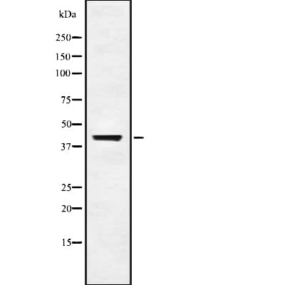 Polyclonal Rabbit anti-Human UBP43 / USP18 Antibody (WB)