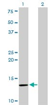 IHC-plus™ Monoclonal Mouse anti-Human B2M / Beta 2 Microglobulin Antibody (clone 3F9-2C2, IHC, IF, WB)