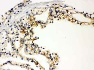 SLC12A1 / NKCC2 Antibody