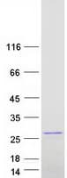 Human RAP1B Protein (Recombinant Myc-DDK (Flag))