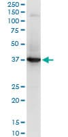 RNF2 / RING2 / RING1B Antibody (clone 2B6)
