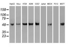 PathPlus™ KRT8 / CK8 / Cytokeratin 8 Antibody (clone 4D12)