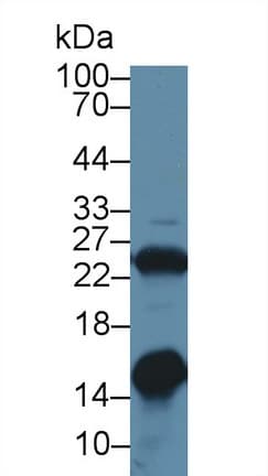 LGALS1 / Galectin 1 Antibody (aa1-135, APC)