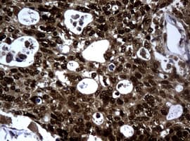Monoclonal Mouse anti-Human PCNA Antibody (clone OTI1D11, IHC, WB)