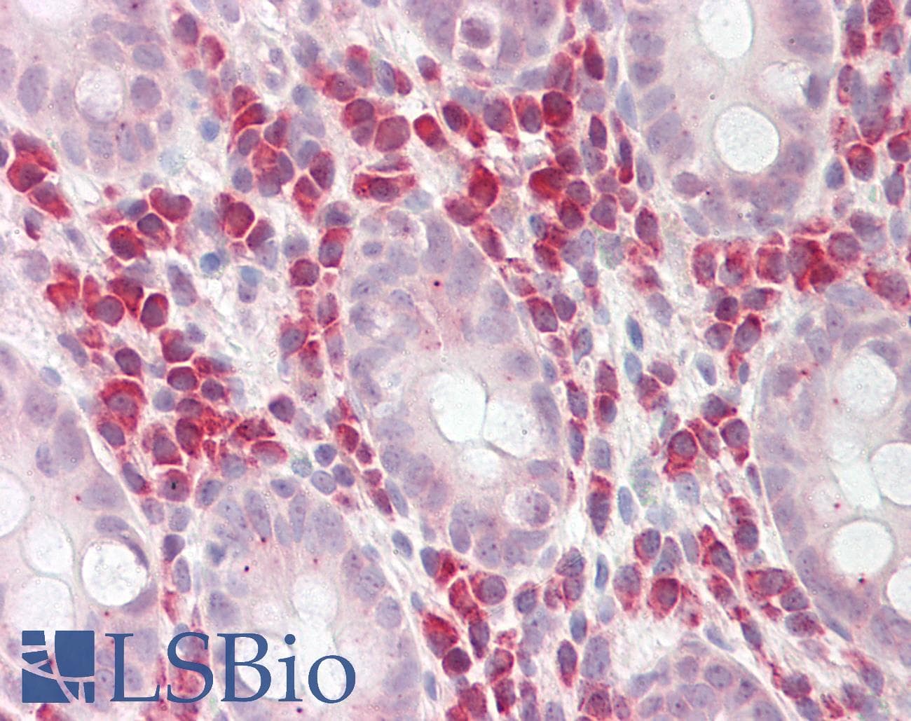 PDE4D Antibody (aa164-213, HRP)