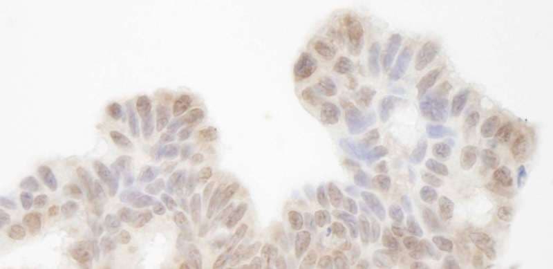Polyclonal Rabbit anti-Human SIN3A Antibody (aa1-50, IHC)