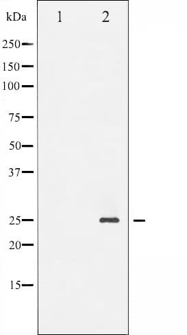 Polyclonal Rabbit anti-Human TNNI3 / Cardiac Troponin I Antibody (phospho-Ser43, IHC, WB)