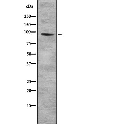 COL9A1 / Collagen IX Antibody