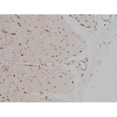 MAPT / Tau Antibody (phospho-Ser404)
