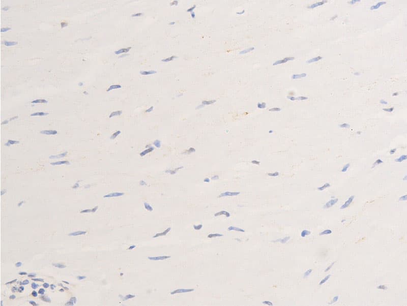 ERBB2 / HER2 Antibody (phospho-Tyr877)