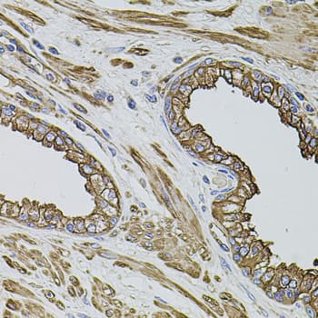FLNB / TAP Antibody
