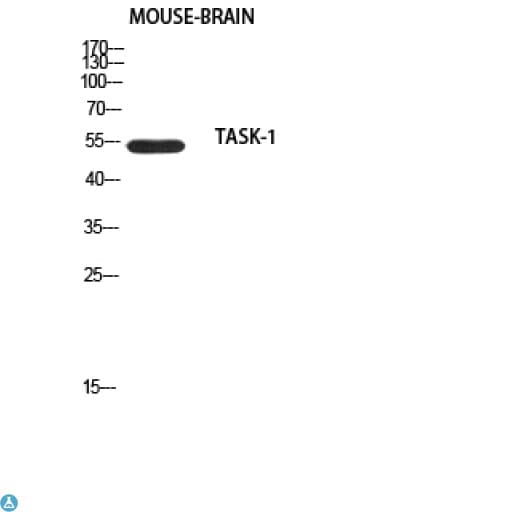 KCNK3 / OAT1 Antibody