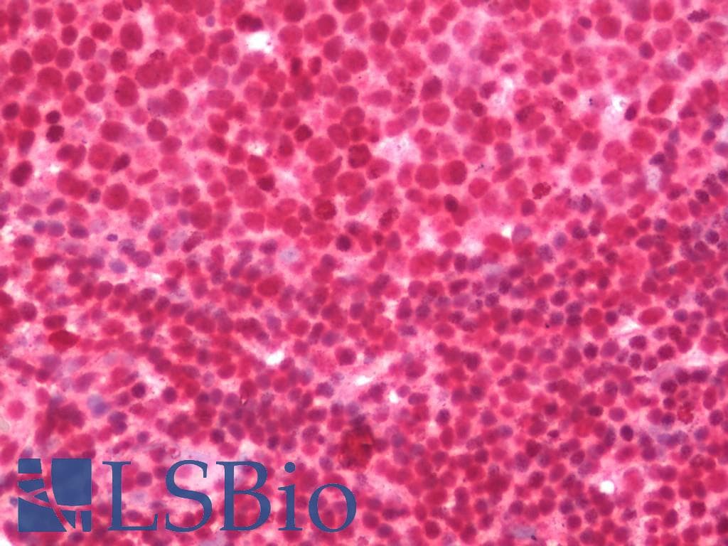 IHC-plus™ Polyclonal Rabbit anti-Human ZFHX3 / ATBF1 Antibody (IHC, IF, WB)