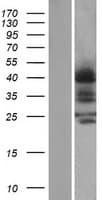 Human CCR4 Protein (Over-Expression Lysate Myc-DDK (Flag))