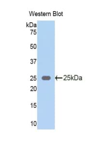 KRT5 / CK5 / Cytokeratin 5 Antibody (aa335-473, Cy3)