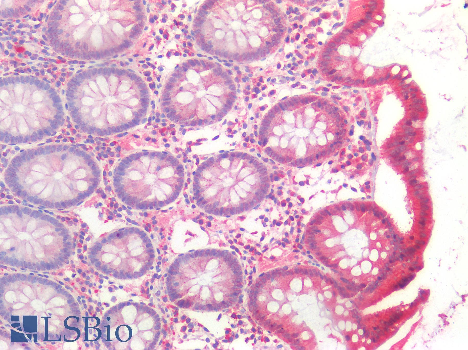 PathPlus™ TJP1 / ZO-1 Antibody