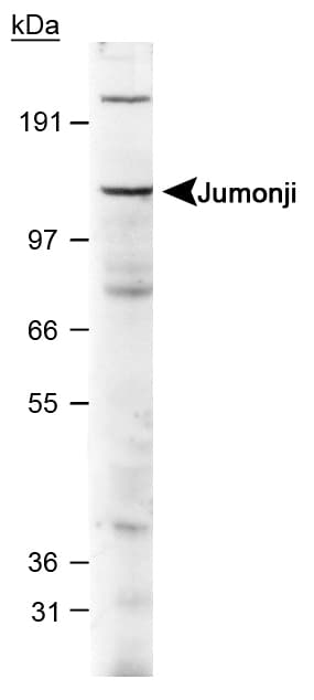 JARID2 / JMJ Antibody (aa1-100)