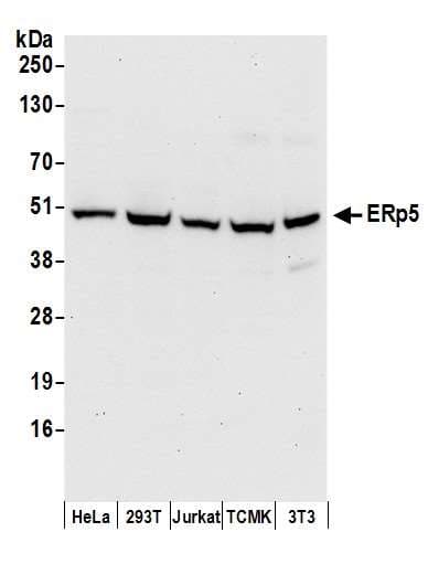 PDIA6 / ERP5 Antibody (aa250-300)