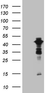 XRCC3 Antibody (aa1-235, clone OTI1C1)
