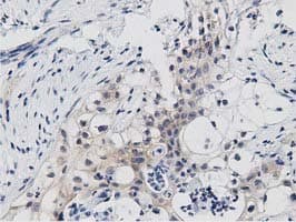 PRKD2 / PKD2 Antibody (clone OTI4F1)